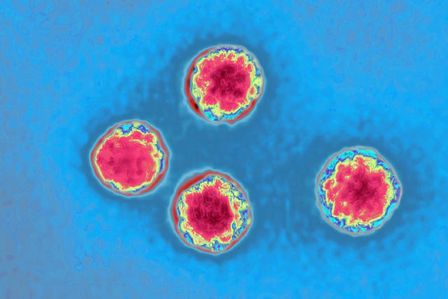 Cryptosporidium Infection: Epidemiology, Pathogenesis, and Differential Diagnosis - PMC